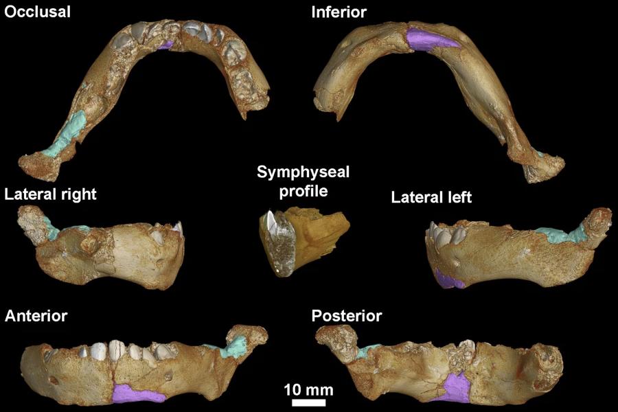 Occlusal Lateral right Anterior Inferior Symphyseal profile Lateral left Posterior 10 mm
